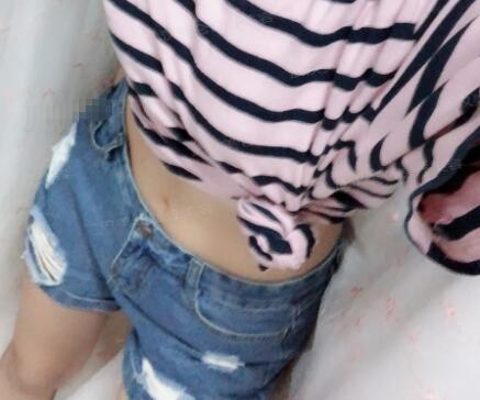 韓式共振吸脂減肥果圖