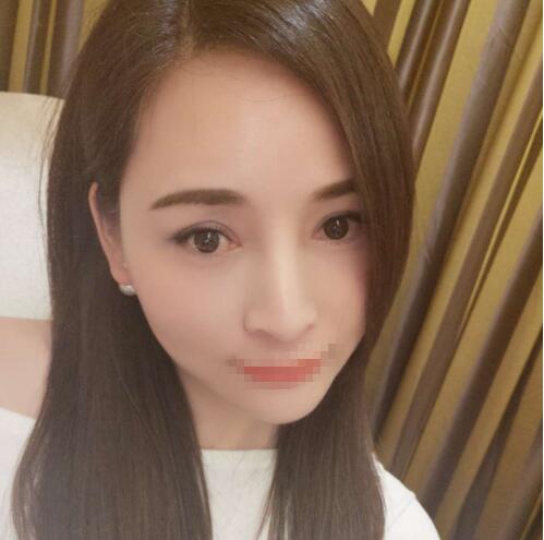 北京百達(dá)麗王維眼修復(fù)案例