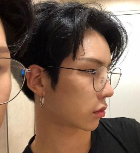 男生顴骨顴弓整形體驗(yàn)日記