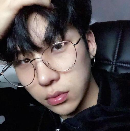 男生顴骨顴弓整形體驗(yàn)日記