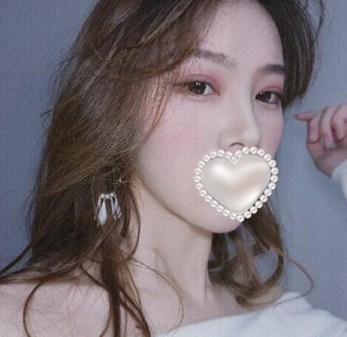 崔榮達做下頜角好嗎？案例分享