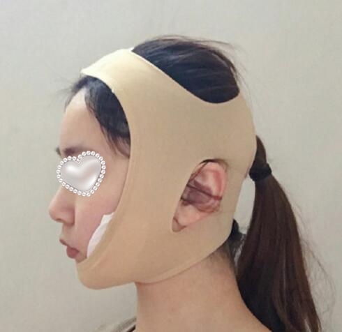 崔榮達做下頜角好嗎？案例分享