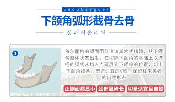 崔榮達醫(yī)生科普下頜角整形手術(shù)