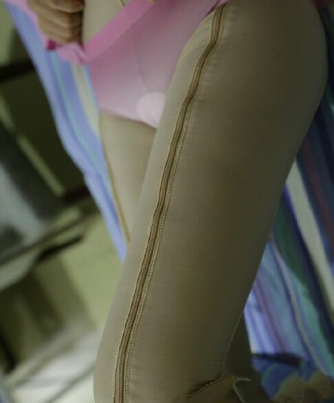 沒多少痛感瘦腿吸脂術(shù)體驗(yàn)過(guò)程