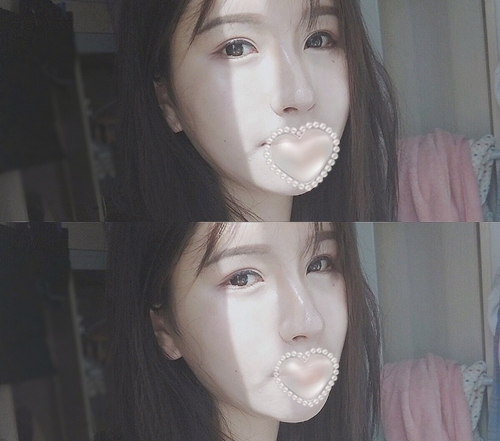 開(kāi)外眼角前后對(duì)比照