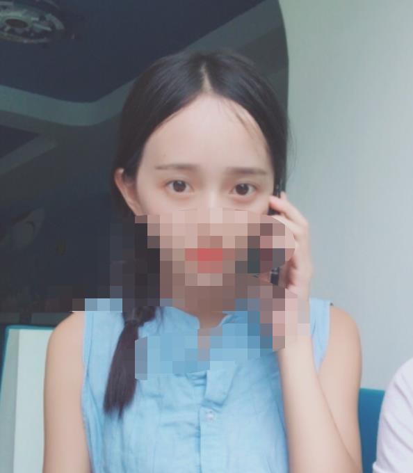 北京八大處趙延勇醫(yī)生做雙眼皮怎么樣？