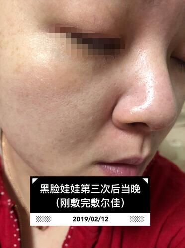 黑臉娃娃體驗(yàn)日記