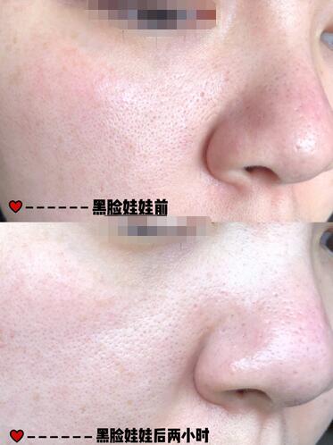 黑臉娃娃前后對(duì)比