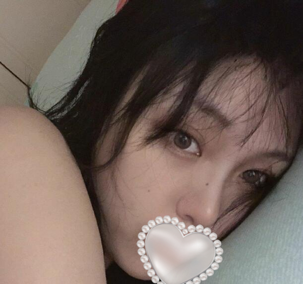 自體脂肪填充下眼瞼手術(shù)經(jīng)過(guò)