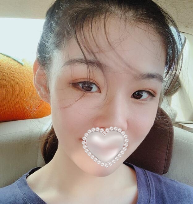 鄭州諾顏一生湯芳芳熱瑪吉案例