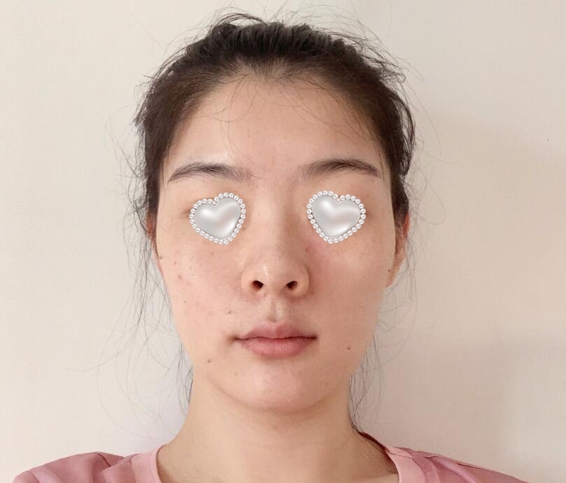 鄭州諾顏一生湯芳芳熱瑪吉案例