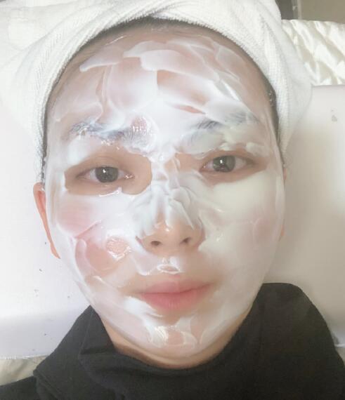 藍寶石激光祛斑體驗日記