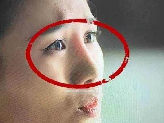 北京硅膠隆鼻的危害科普