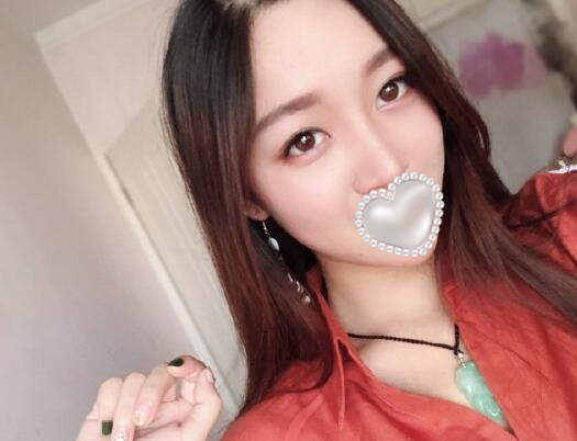 衡陽雅美姚江華醫(yī)生脂肪填充?案例