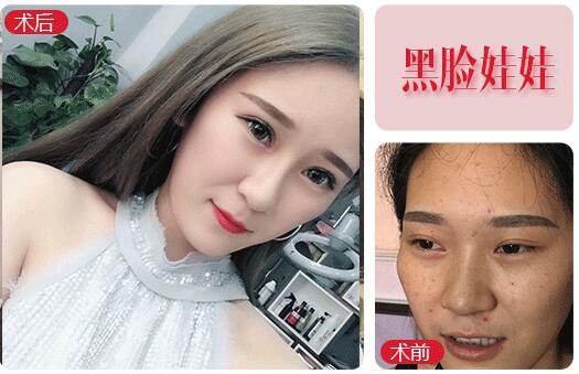 黑臉娃娃價(jià)格是多少