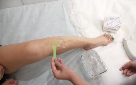 小腿激光脫毛體驗分享