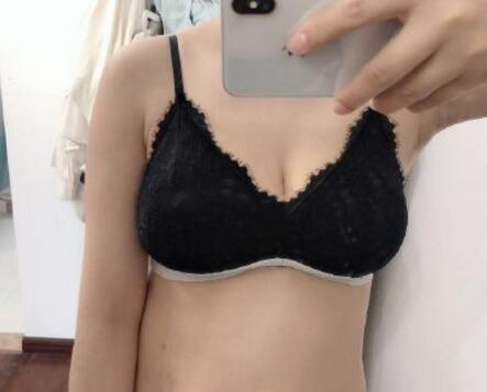 奧美定取出術(shù)后果圖