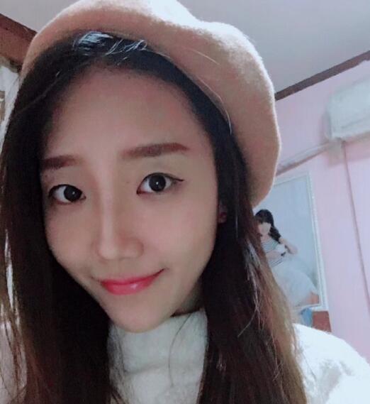 北京祛眼袋術(shù)后果圖對(duì)比