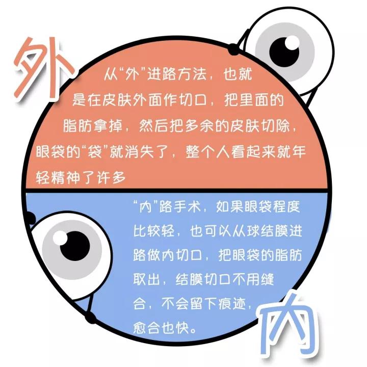 祛眼袋內(nèi)切法和外切法的對(duì)比