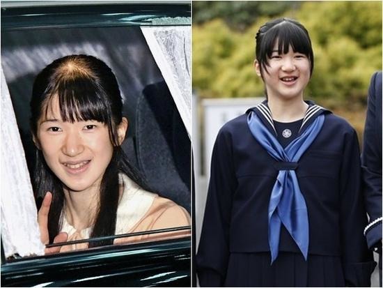 公主暴瘦成蛇精臉是咋回事