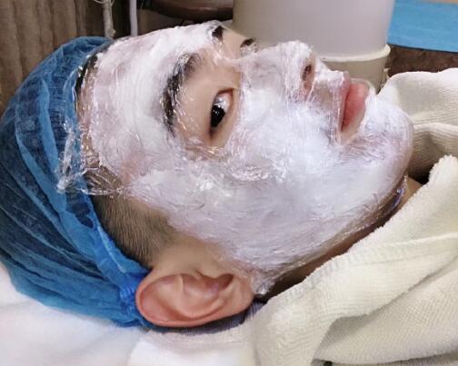 像素激光調節(jié)痘疤體驗日記