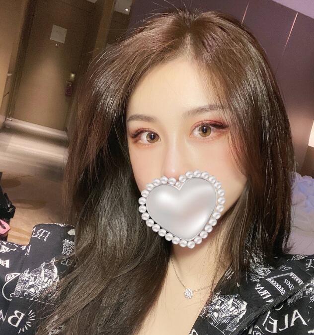 做隆鼻手術(shù)后果圖分享