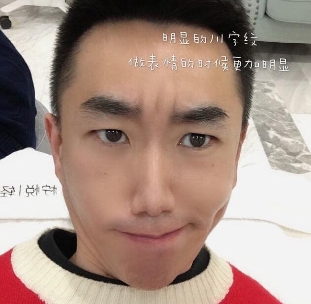 眉間注射除皺果怎么樣