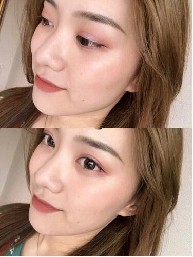 四、眉部整形紋眉手術(shù)果圖?