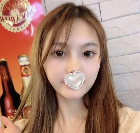 威塑吸脂面部果圖