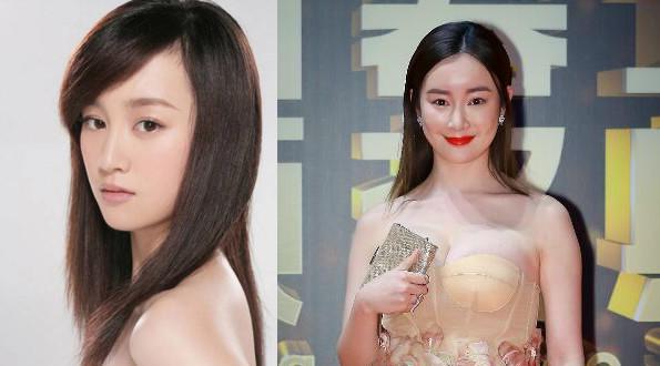 張檬整容前后照片對比