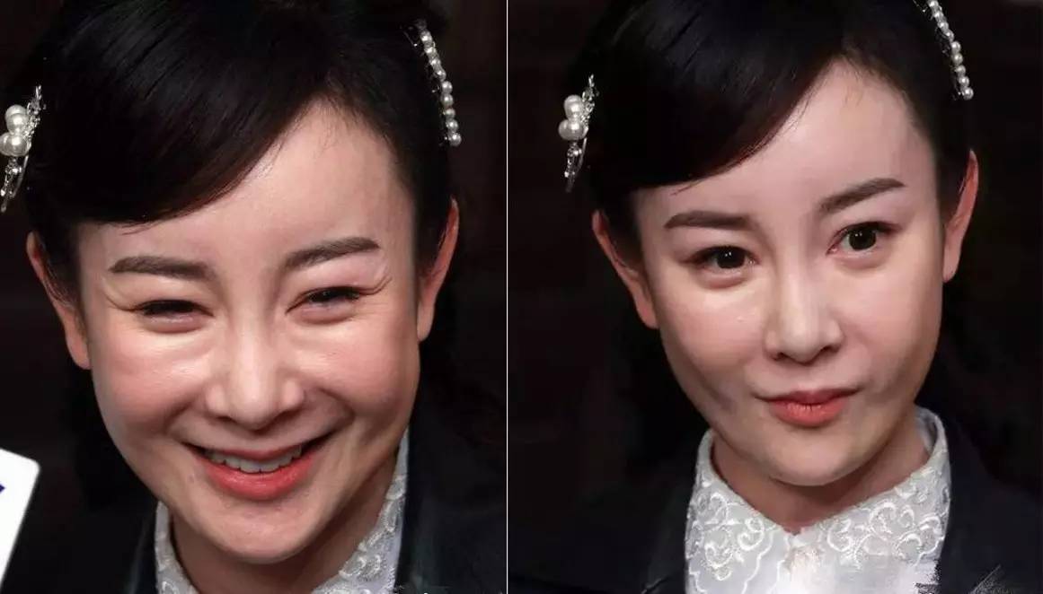 張檬整容前后照片對比