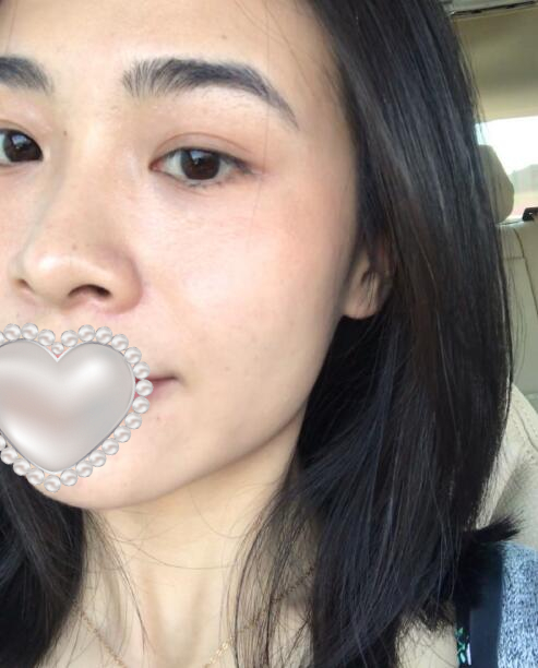 去黑頭黑臉娃娃果圖對比?