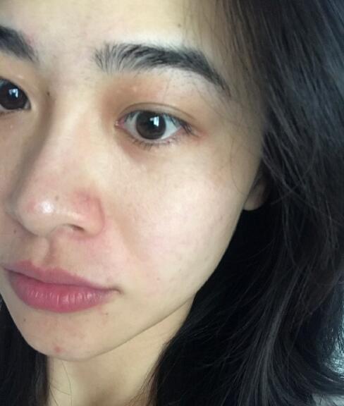 去黑頭黑臉娃娃果圖對比?