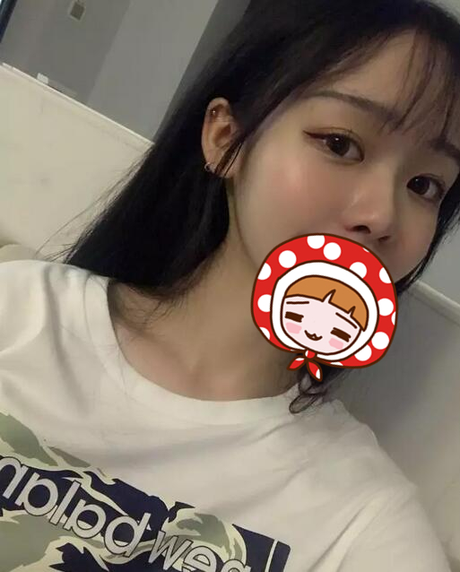 北京硅膠隆鼻手術(shù)果圖