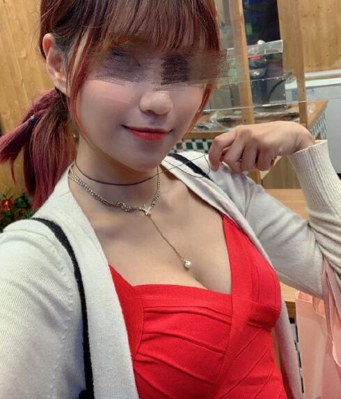 假體隆胸果圖分享