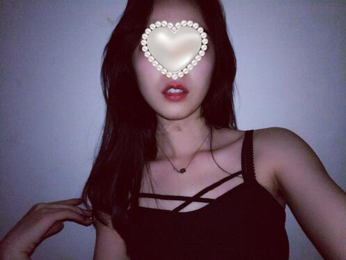 廣州牙齒整形種植牙果圖