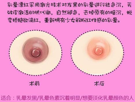 怎樣使乳暈變紅