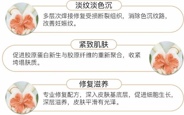 妊娠紋去除方法