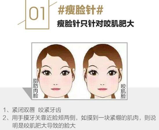 什么是注射瘦臉