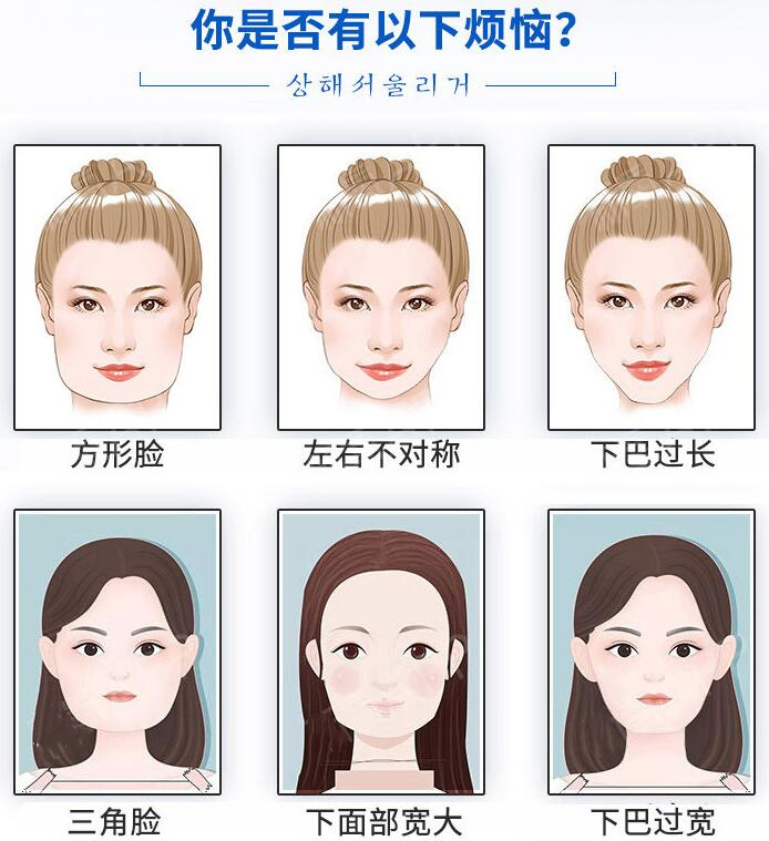 整瓜子臉需要多少錢