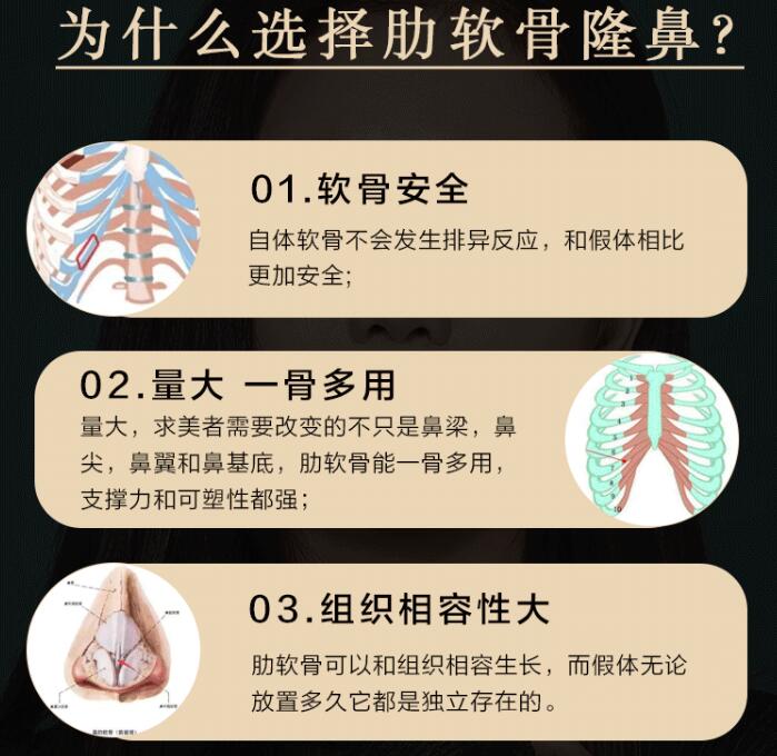 溫州美域高高志丹醫(yī)生科普隆鼻整形