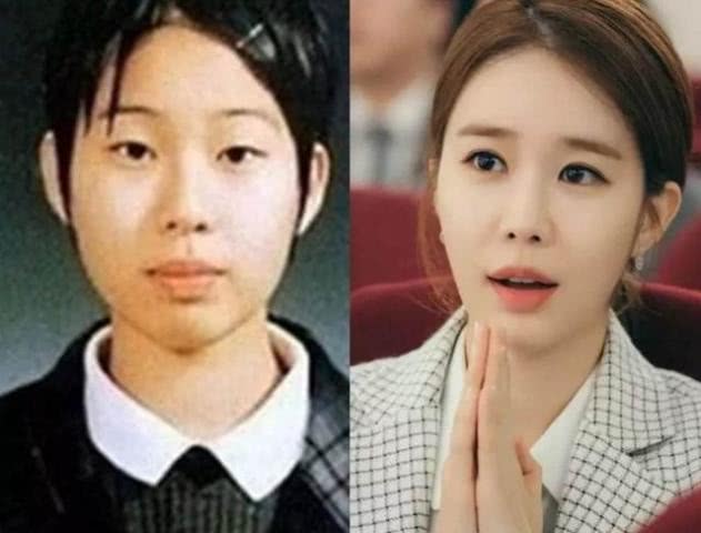 劉仁娜整容前對比