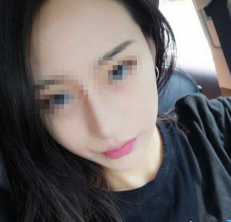 削骨瘦臉果圖分享