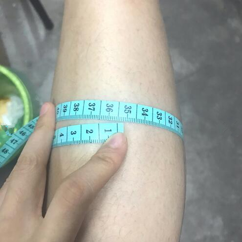 注射瘦臉注射瘦腿術(shù)后果圖分享