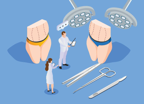 做腹壁整形手術(shù)有什么后遺癥？真實(shí)數(shù)據(jù)+3個(gè)避坑技巧，別只看效果不看風(fēng)險(xiǎn)