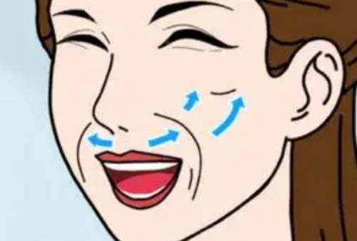 玻尿酸打法令紋能維持多久？維持時間+復打周期全說清