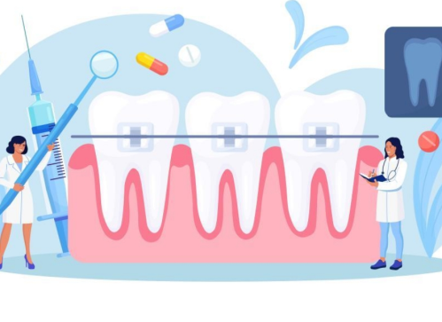 浙一牙齒矯正多少錢？附不同矯正方案的費用對比