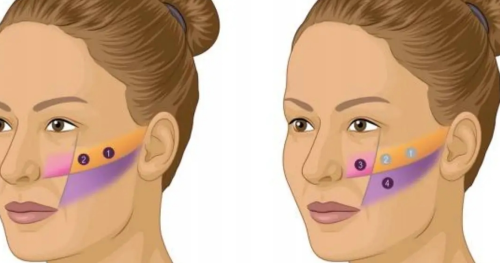 修復(fù)饅化臉恢復(fù)期多久?各階段恢復(fù)情況和注意事項(xiàng)整理