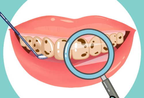 重慶齊美牙齒貼面價格，不同材質(zhì)收費差別先了解