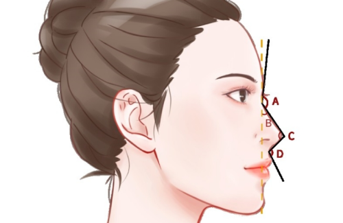 填高鼻梁哪種方法好？不同基礎和訴求差別很大